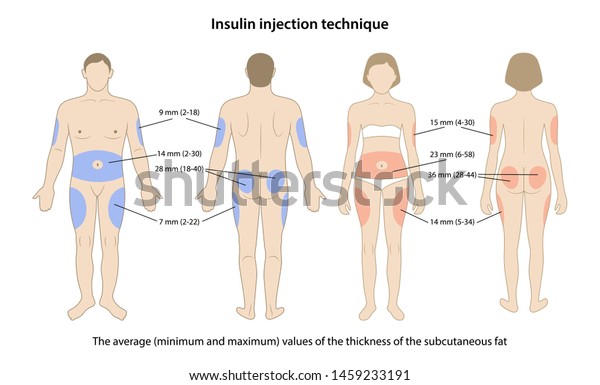 Diabetes. Average, minimum and maximum values of\
the thickness of the subcutaneous fat on the insulin injection\
sites are shown on male and female bodies. Vector illustration in\
flat style.
