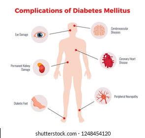 Diabetes complications medical educational chart poster with affected human organs damages depiction and description flat vector illustration