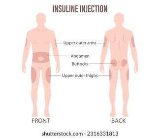 Diabetes. Insulin injection sites on the human body, upper arms, abdomen, buttocks, upper thighs. Medical infographic banner, poster