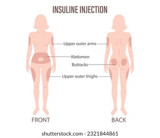 Diabetes. Insulin injection sites on the human body, upper arms, abdomen, buttocks, upper thighs. Medical infographic banner, poster