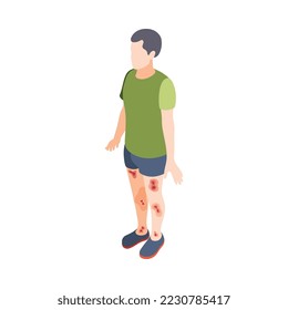 Diabetes isometric composition with isolated human character of suffering person vector illustration
