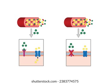 Diabetes mellitus type 2, cells fail to respond to insulin (Insulin resistance). high blood glucose levels. Vector Diagram illustration.