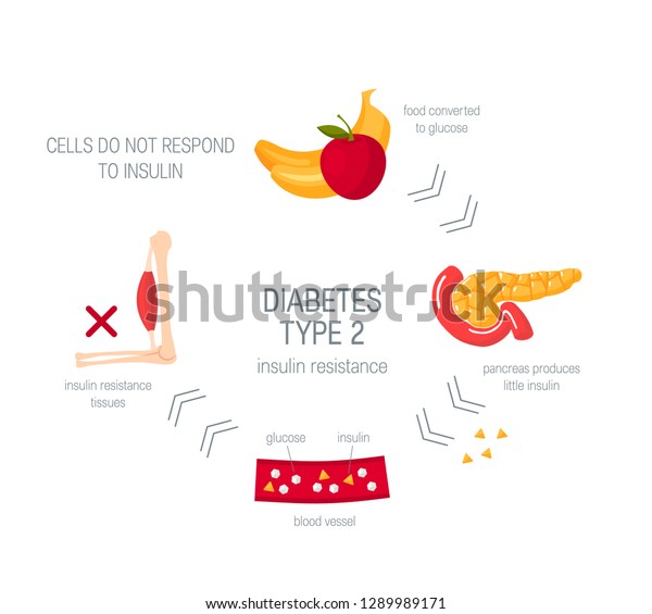 Diabetes Type 2 Concept Diagram Medical Stock Vector (Royalty Free ...