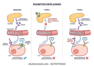 Diabetesarten, die mit einem Schema erläutert werden, das die Bauchspeicheldrüse, das Blutgefäß und die Zelle zeigt, um die Insulinfunktion und die Glukoseaufnahme zu veranschaulichen. Gliederungsplan