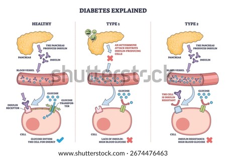 Diabetes types explained with an outline diagram showing pancreas, blood vessel, and cell to illustrate insulin function and glucose uptake. Outline diagram