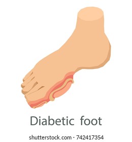 Diabetic Foot Icon. Isometric Illustration Of Diabetic Foot Vector Icon For Web