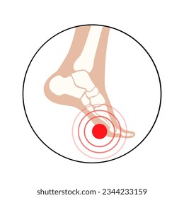 Diabetic foot syndrome Icon. Deep ulcer, open sore or wound on feet. Inflammation in the ligaments, tendon and bones. Gangrene infection and amputation. Pain in leg, diagnostic and treatment vector.