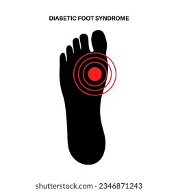 Diabetic foot syndrome Icon. Deep ulcer, open sore or wound on feet. Inflammation in the ligaments, tendon and bones. Gangrene infection and amputation. Pain in leg, diagnostic and treatment vector.