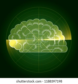 Diagnosis of brain disorders. Medical concept design.