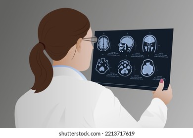 Diagnosis of diseases of the brain in a doctor looking at magnetic resonance imaging (MRI) Diagnosis of a patient's neurodegenerative disease	