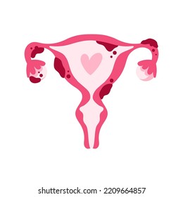 Diagnóstico Endometriosis, sistema reproductivo hembra enfermiza aislada en el fondo blanco.