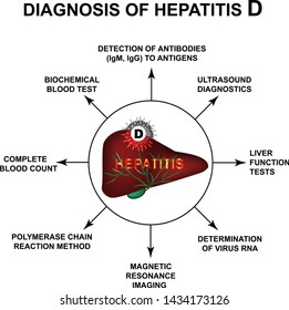 Diagnosis of hepatitis D. World Hepatitis Day. Infographics. Vector illustration on isolated background.