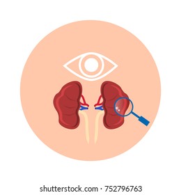 Diagnosis of human kidney disease. Vector illustration.