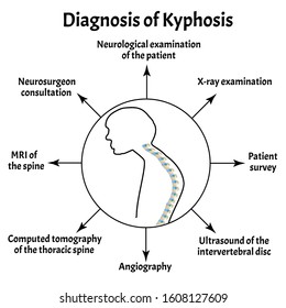 Diagnosis of kyphosis. Spinal curvature, kyphosis, lordosis, scoliosis, arthrosis. Improper posture and stoop. Infographics. Vector illustration on isolated background.