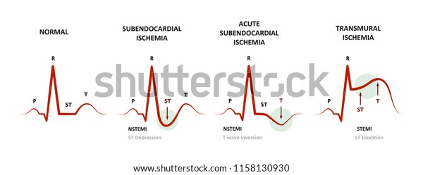 cardiograph free download