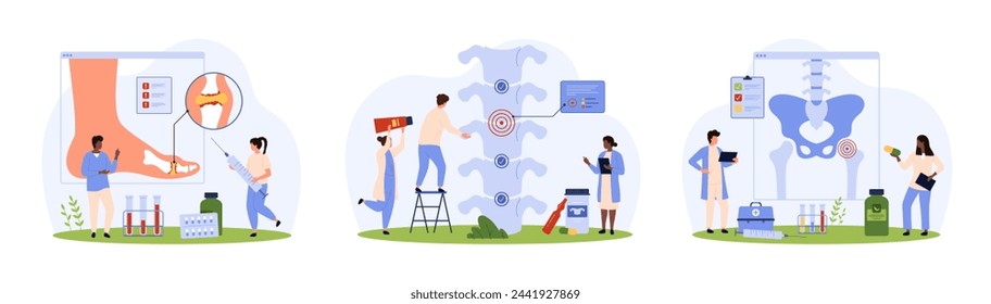 Diagnosis and treatment of osteoarthritis, rheumatoid arthritis set. Tiny people research with xray and medical charts inflammation of foot and hip joint, spinal cartilage cartoon vector illustration