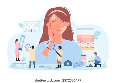 Diagnosis and treatment of vitiligo vector illustration. Cartoon tiny people with magnifying glass examine skin of giant happy woman with vitiligo, dermatologists treat autoimmune disease of epidermis