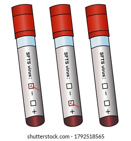 Diagnósticos de muestras de sangre para el virus SFTS. Tubos con análisis de pacientes. Conjunto de vector de color. Tres resultados: positivo, negativo, no preparado. Fondo blanco aislado. Recogida de muestras clínicas. 