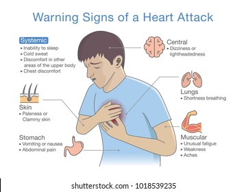 Symptoms of heart attack