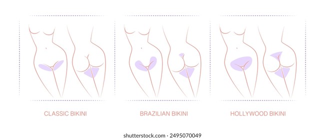 Diagram with designated areas for hair removal. Borders for hair removal: Classic bikini, Brazilian bikini, Hollywood bikini. Female epilation, depilation for girls.