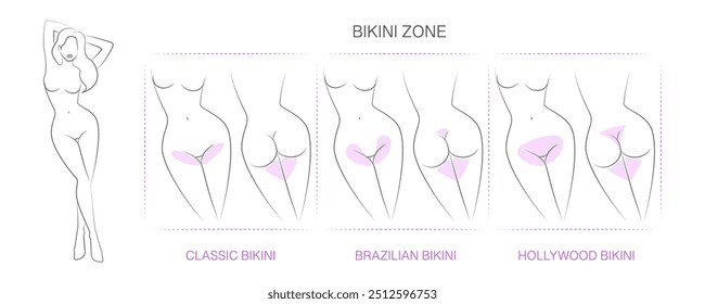 Diagrama com áreas designadas para remoção de pelos. Bordas para remoção de cabelo: biquíni clássico, biquíni brasileiro, biquíni de Hollywood. Epilação feminina, depilação para meninas.