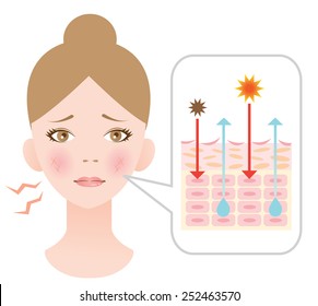 diagram of dry skin.infographic skin illustration