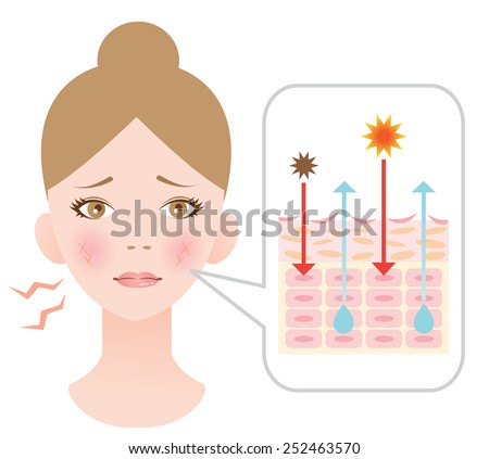 Diagram Dry Skininfographic Skin Illustration Stock Vector (Royalty ...