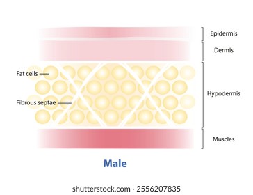 Diagram of Fibrous septae in men skin structure vector illustration on white background. The septae of men are oriented at 45° angles to the skin in a crisscrossing pattern, horizontally, diagonally.