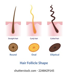 Diagrama de la forma del folículo capilar ilustración del vector aislado sobre fondo blanco. Sección transversal de folículos redondos, ovalados y elípticos. Cabello recto, rizado y enrollado con capa de cuero cabelludo. Anatomía del pelo.