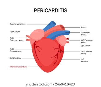 Diagram of human heart with pericarditis disease