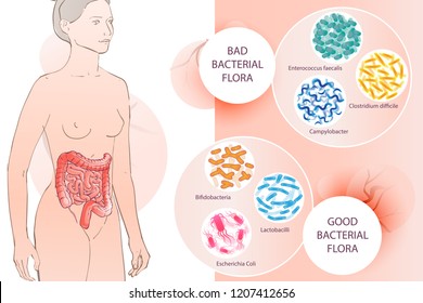 diagram illustration of the human colon.GOOD BACTERIAL FLORA. Hand drown isolated illustration, sketch vector