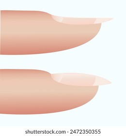 Diagramm der Nagelplatte. Schema der Nagelstruktur. Vektorgrafik Bild des Nagelbetts. Einzigartige Darstellung. Abbildung eines Nagels