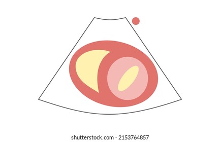Diagram of Parasternal Short Axis View at Mitral Valve of Echocardiography. Healthcare Concept