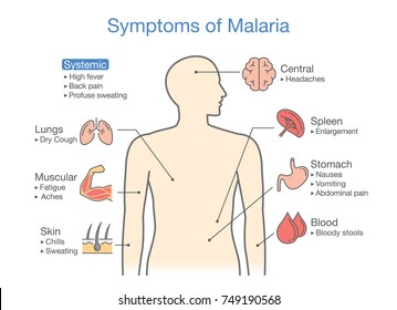what are the symptoms for malaria