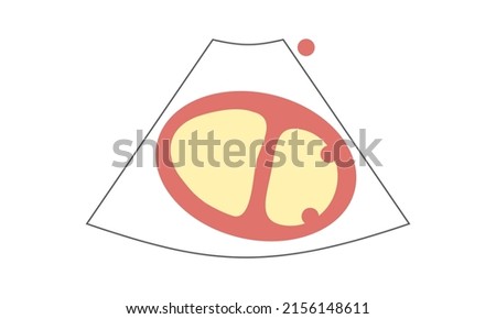 Diagram of right Ventricle D Shape of Parasternal Short Axis View at Papillary Muscle of Echocardiography. Healthcare Concept