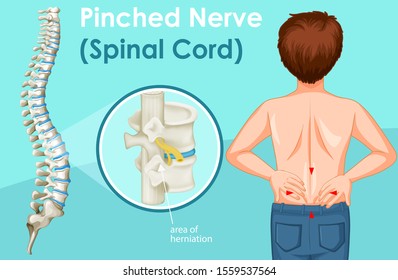 Diagram showing back pain in human illustration