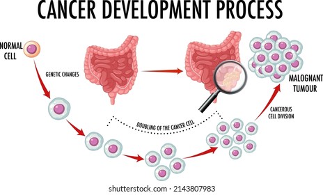 Diagram showing cancer development process illustration
