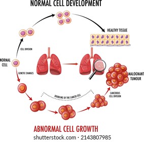 Diagram showing cancer development process illustration