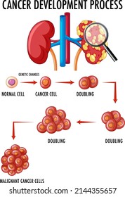 Diagram showing cancer development process illustration