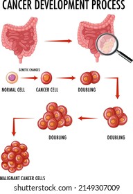 Diagram Showing Cancer Development Process Illustration Stock Vector ...