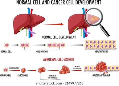 Diagram showing cancer development process illustration