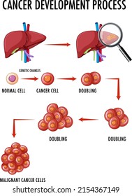 Diagram showing cancer development process illustration