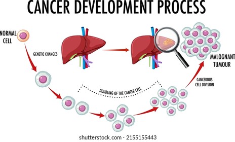 Diagrama que muestra la ilustración del proceso de desarrollo del cáncer
