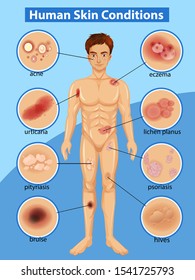 Diagram showing differen human skin conditions illustration