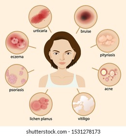 Diagram showing different sickness illustration