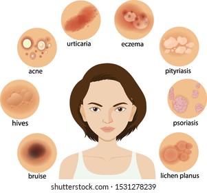 Diagram showing different skin conditions illustration