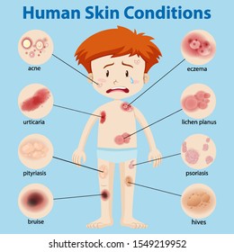 Diagram showing different skin conditions illustration