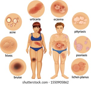 Diagram showing different skin diseases illustration