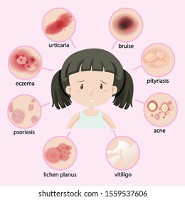 Diagram showing different types of disease in kid illustration