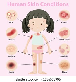 Diagram showing human skin conditions illustration